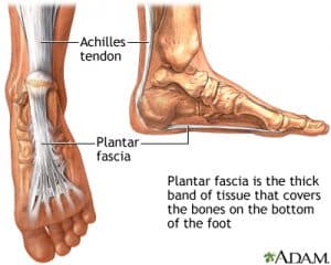 tennis heel pain